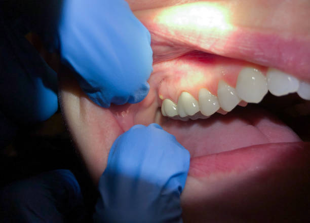 Best Broken Tooth Emergency  in Hopwood, PA